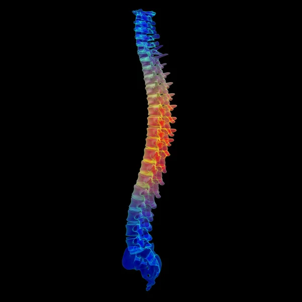 3d renderizar columna vertebral dolorosa —  Fotos de Stock