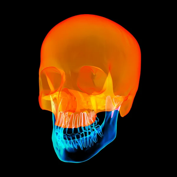 Human Skull. Upper half. with black background - right front view — Stock Photo, Image