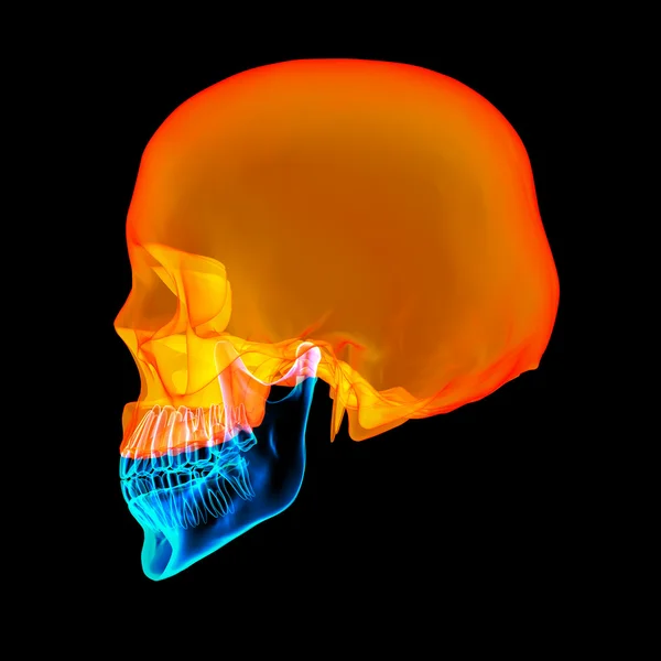 Menselijke schedel. De bovenste helft. met zwarte achtergrond - zijaanzicht — Stockfoto