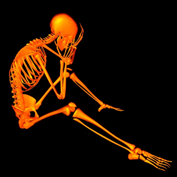 3d esqueleto laranja renderizado de uma sessão - dor de cabeça — Fotografia de Stock