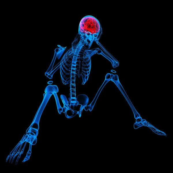 Трехмерный синий скелет сидящего - headache — стоковое фото
