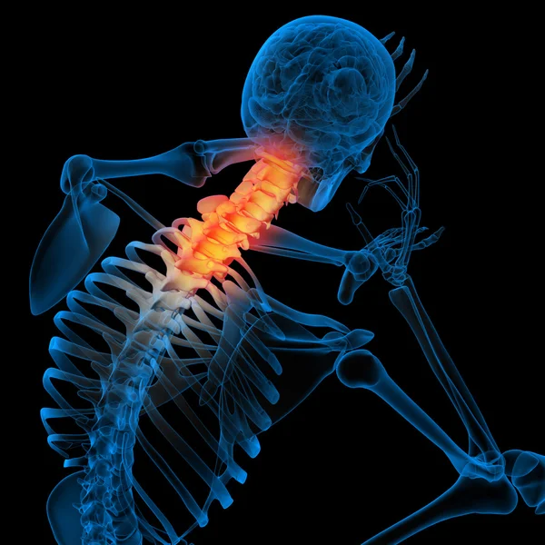 El esqueleto del hombre con la columna vertebral - el dolor del cuello — Foto de Stock