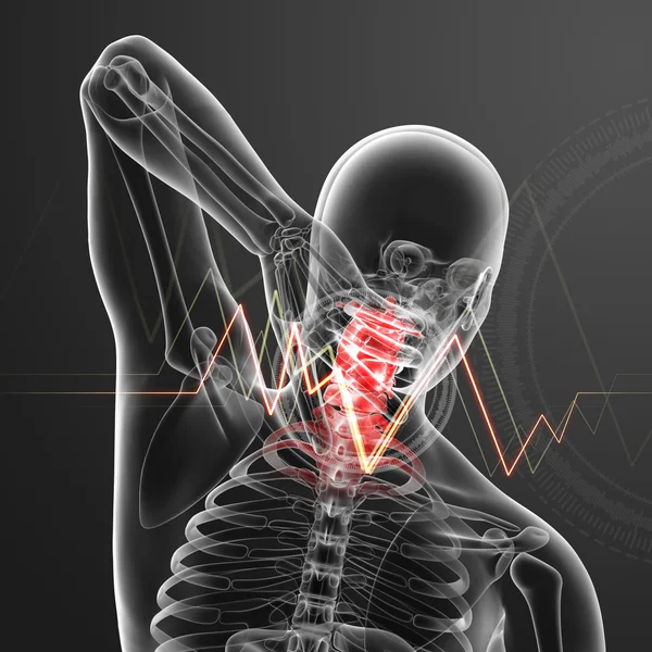3d renderizado ilustración - dolor de cuello — Foto de Stock