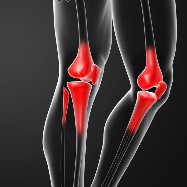 Human knee pain with the anatomy of a skeleton leg — Stock Photo, Image