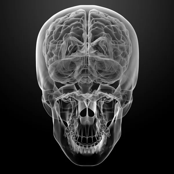 Mänskliga hjärnan x ray — Stockfoto
