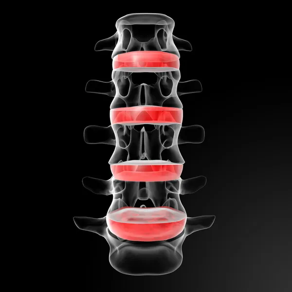 intervertebral diskler