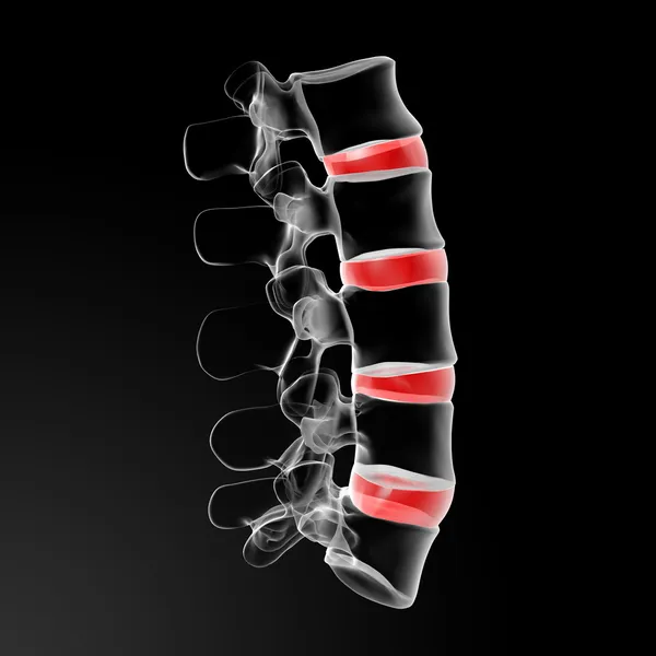 Intervertebral discs — Stock Photo, Image