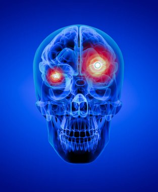 insan beyin x ışını - Önden Görünüm