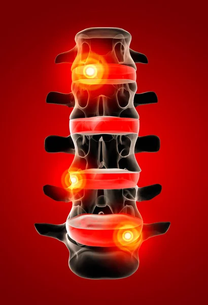 Render Human Intervertebral Discs Front View — Stock Photo, Image