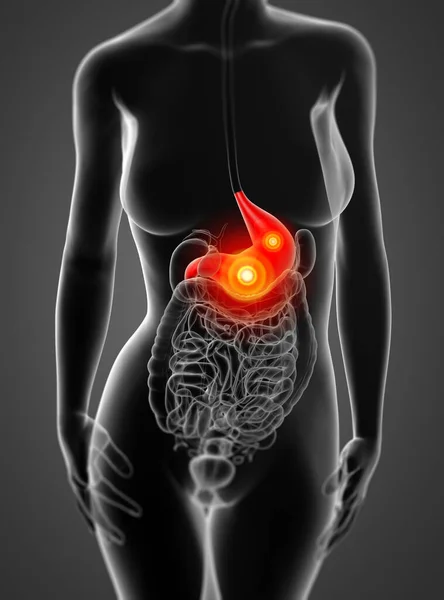 女性の胃 正面の レンダリング — ストック写真
