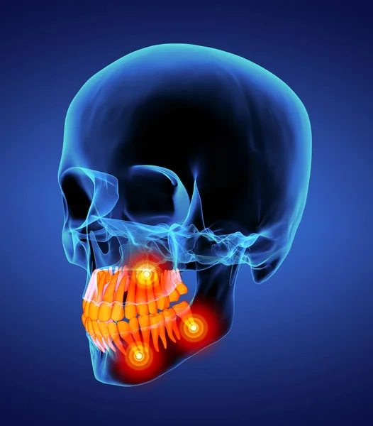 头骨与可见牙齿 侧视图 — 图库照片