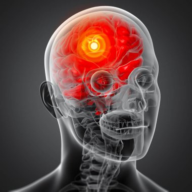 insan beyin x ışını - yakın çekim