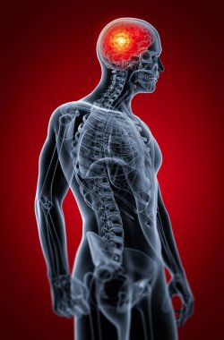 insan beyin x ışını - arkadan görünüm