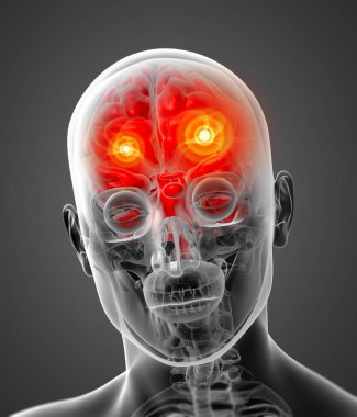 insan beyin x ışını - yakın çekim