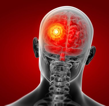 insan beyin x ışını - arkadan görünüm