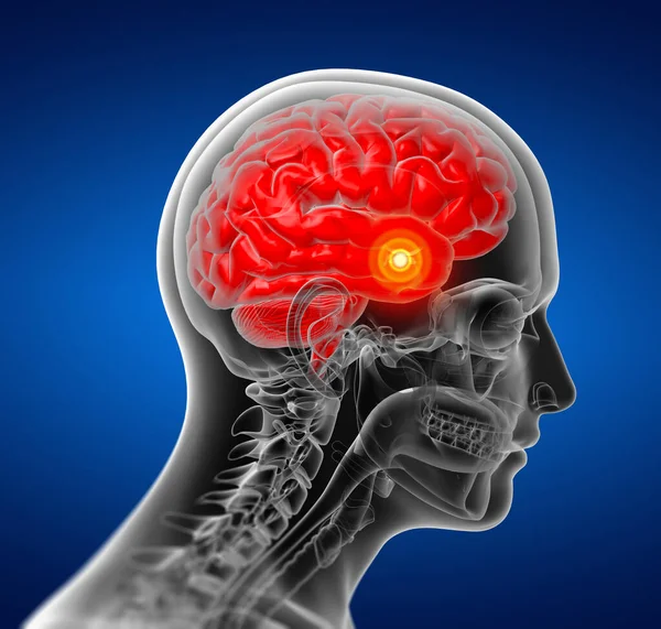 Rentgen Lidského Mozku Detailní Záběr — Stock fotografie