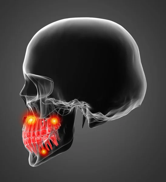 Skull Visible Red Teeth Side View — Stock Photo, Image