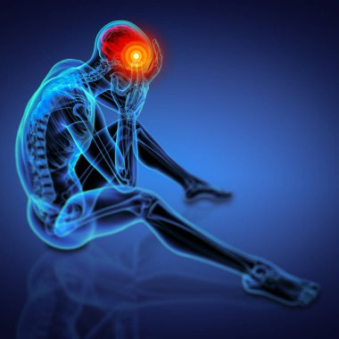 oturma - baş ağrısı - in 3D Render mavi iskelet yan görünüm