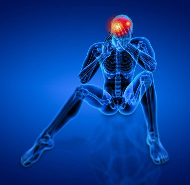 3d render a oturan - insan baş ağrısı