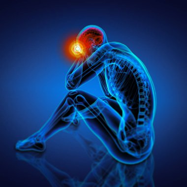 oturma - baş ağrısı - in 3D Render mavi iskelet yan görünüm