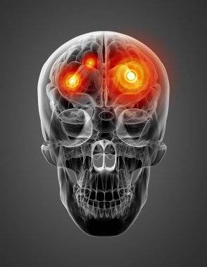 insan beyin x ışını - Önden Görünüm