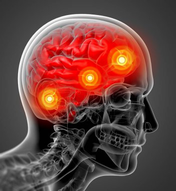 insan beyin x ışını - arkadan görünüm