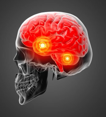 insan beyin x ışını - arkadan görünüm