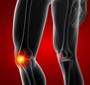 3D render illüstrasyon diz kapağı