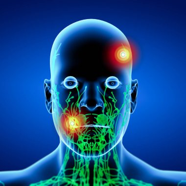 Lenfleribile baş - Önden Görünüm