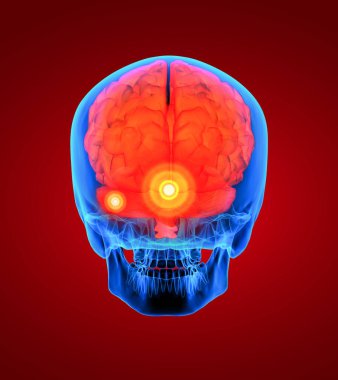 insan kırmızı beyin x ışını - arkadan görünüm