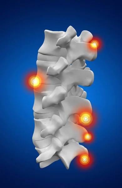 Humano Con Columna Vertebral —  Fotos de Stock