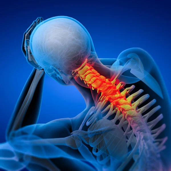 Rendered Illustration Pain Neck — Stock Photo, Image