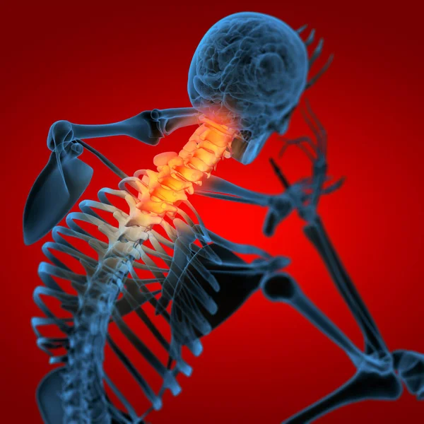 Esqueleto Del Hombre Con Columna Vertebral Dolor Del Cuello — Foto de Stock