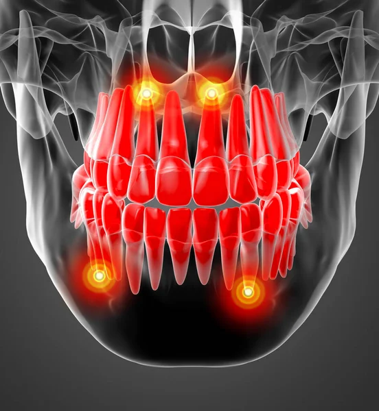 Schädel Mit Sichtbaren Roten Zähnen Nahaufnahme — Stockfoto