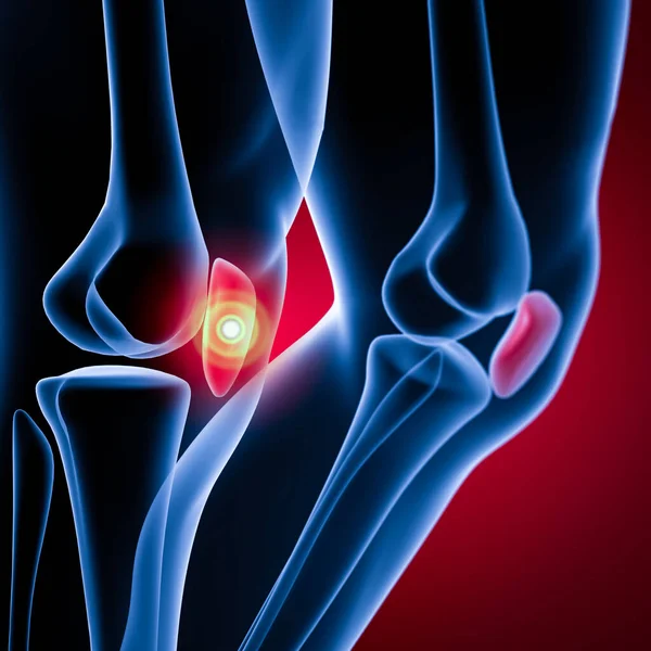 Render Illustration Patella — Stock Photo, Image