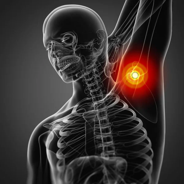 Gerenderte Illustration Nackenschmerzen — Stockfoto