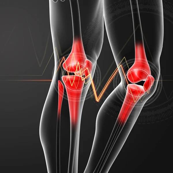 Human Knee Pain Anatomy Skeleton Leg — Stock Photo, Image