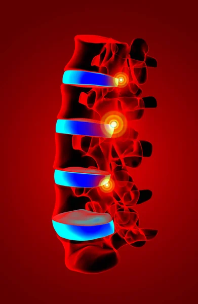 Renderizado Estructura Columna Vertebral Sobre Fondo Negro Con Disco Espinal —  Fotos de Stock