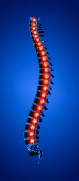 Rendered Illustration Human Spine — Stock Photo, Image