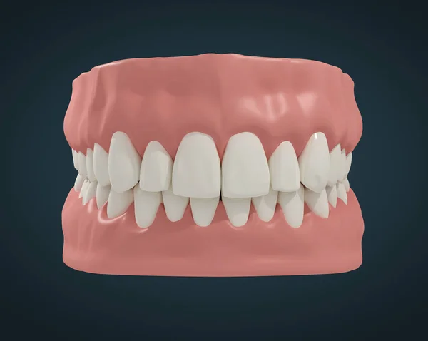 Zęby Czarnym Tle — Zdjęcie stockowe