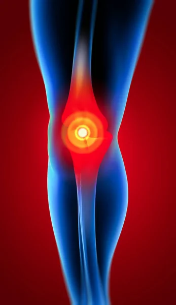 スケルトンの足の解剖学人間の膝の痛み — ストック写真