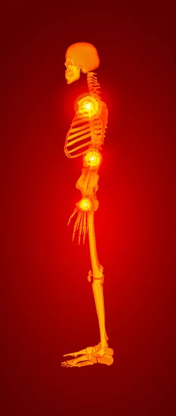 Esqueleto Vermelho Visão Lateral — Fotografia de Stock
