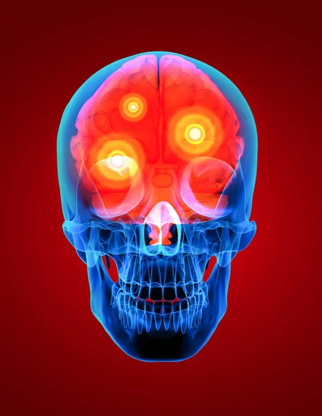 insan kırmızı beyin x ışını - Önden Görünüm