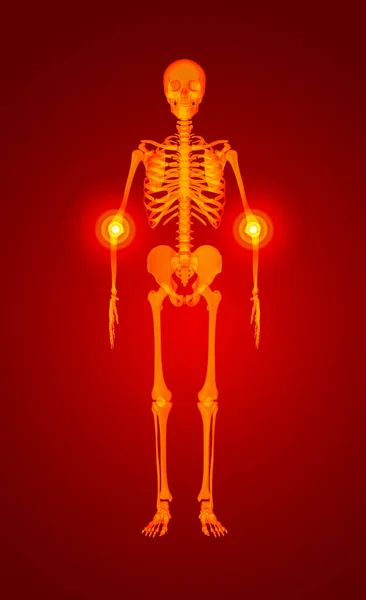 Ilustração Esqueleto Vermelho — Fotografia de Stock