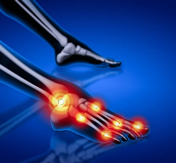 骨架的脚的解剖人体足部疼痛 — 图库照片#
