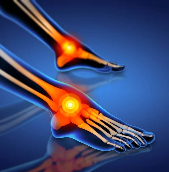 足首の痛みの3Dイラスト ストック画像