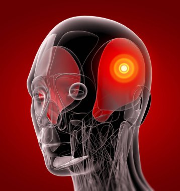 tıbbi temporalis gösterimi