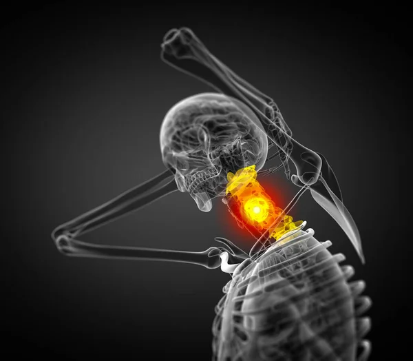 Render Medical Illustration Cervical Spine Side View — Stock Photo, Image