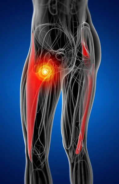 テンソル大腿筋膜の医療イラスト — ストック写真