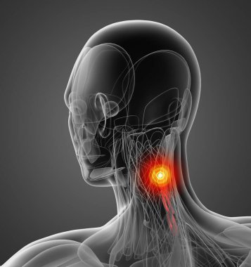 Servikal çıkartabilir kas tıbbi çizimi